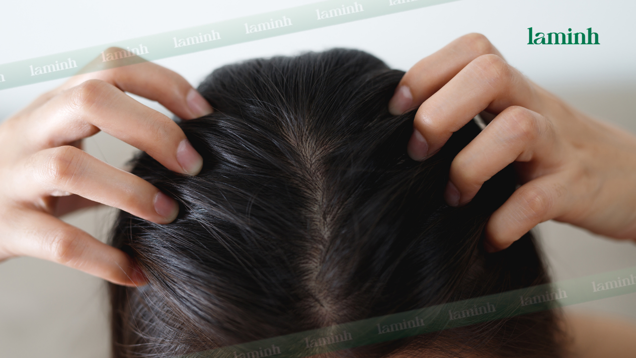 Dầu gội Revitagrow phù hợp cho da đầu dầu